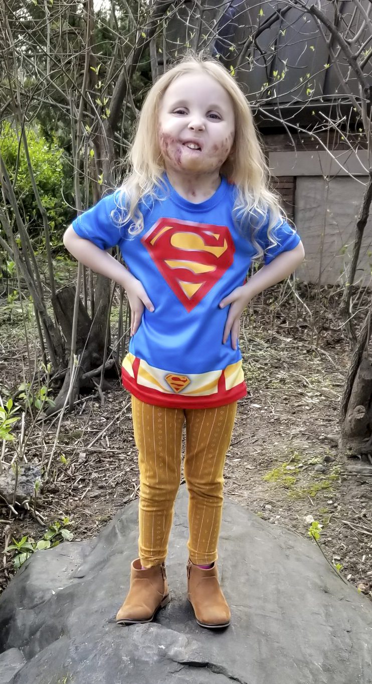 Supergirl