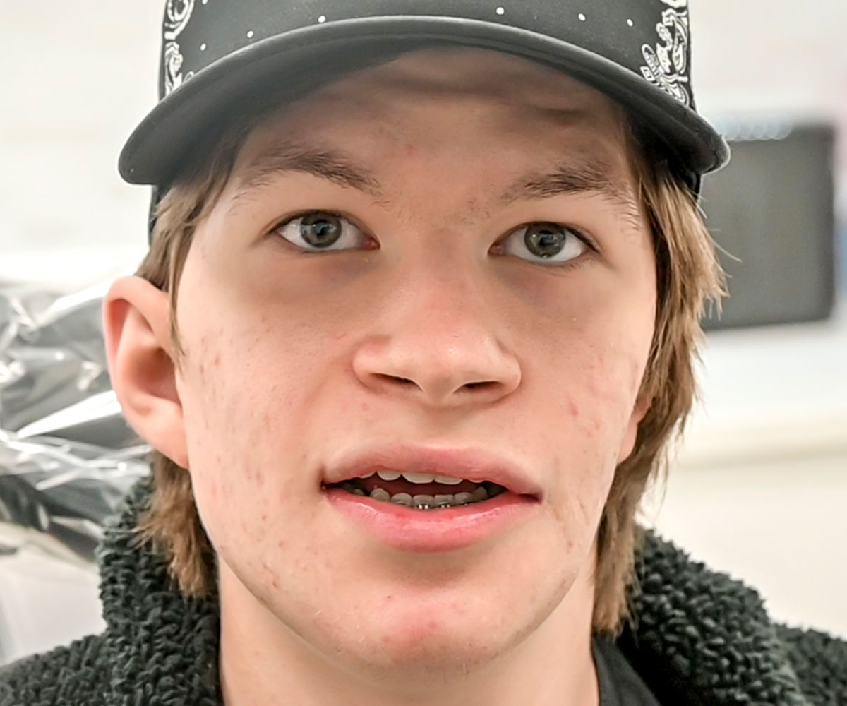 Dylan After