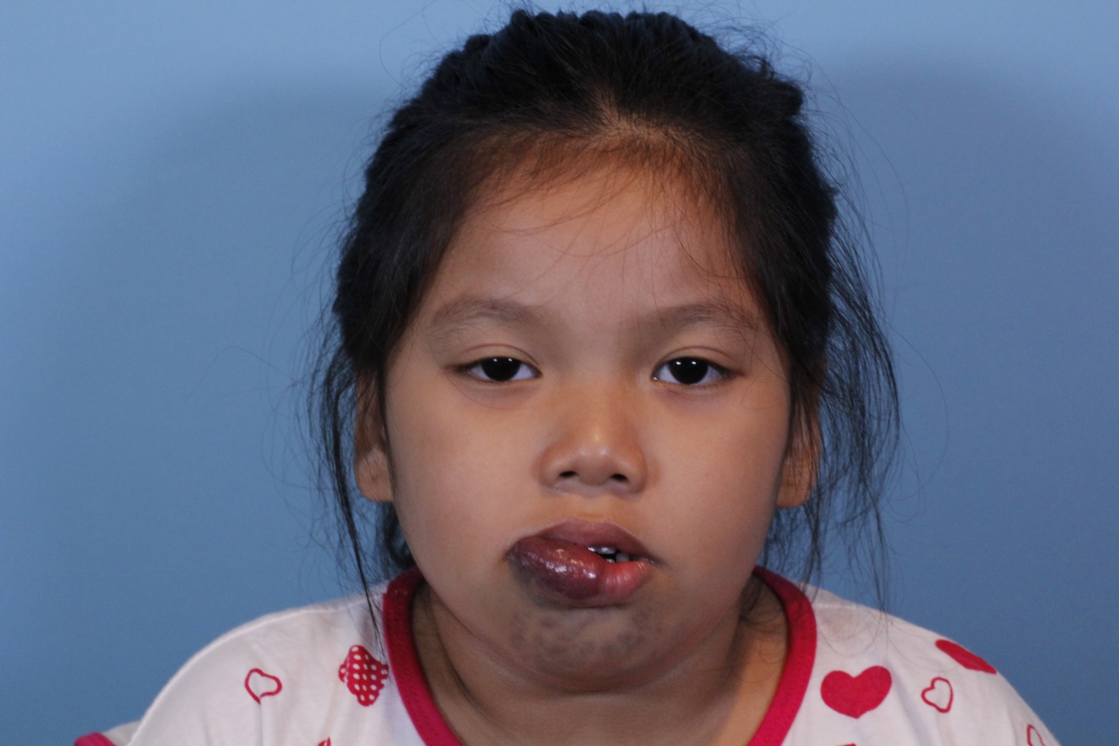 Anisa Before